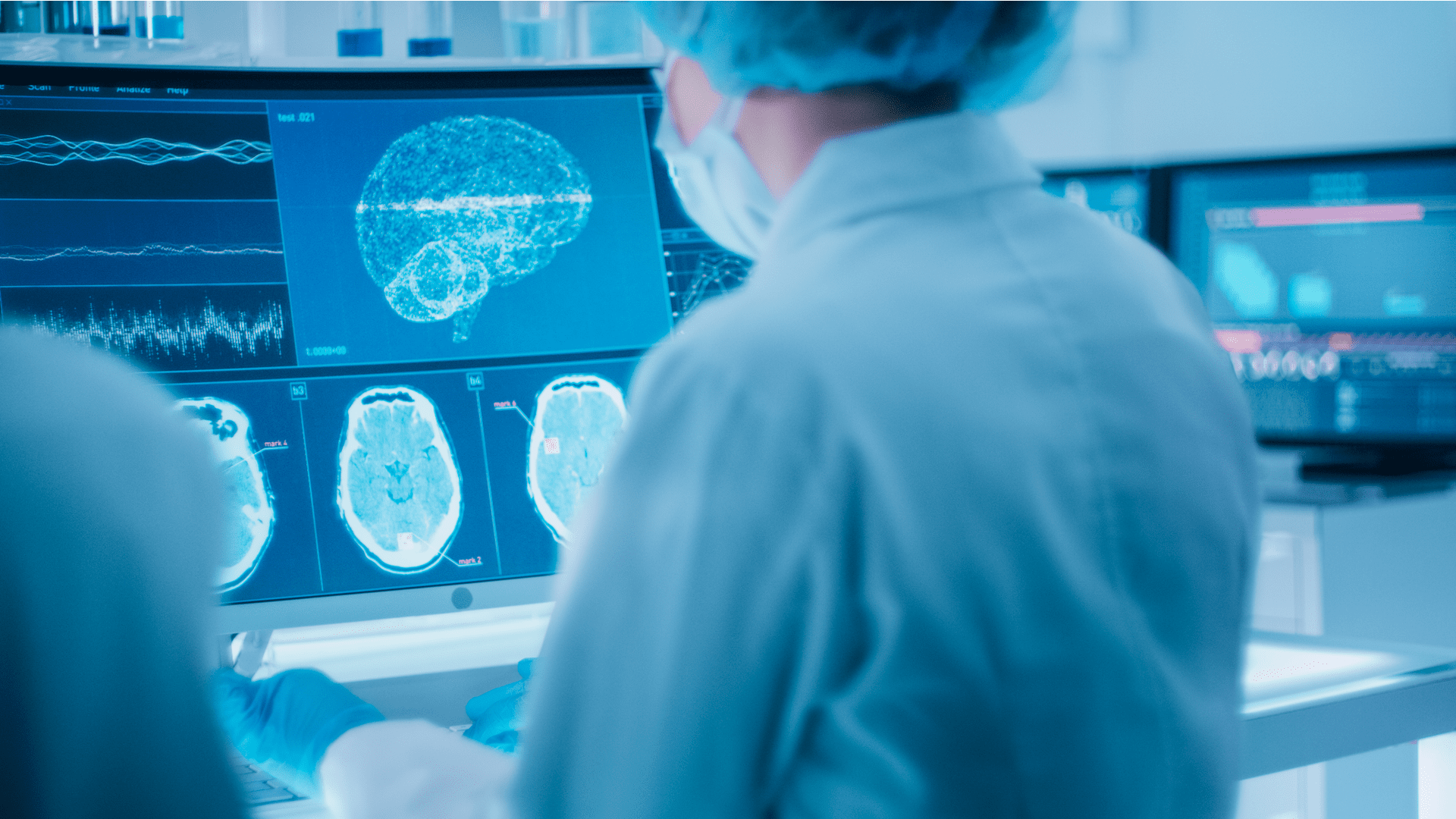 healthcare brain scan